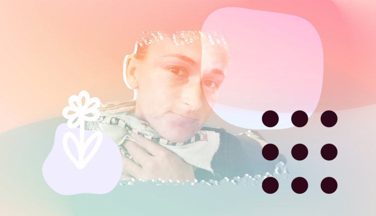 The Hidden Scars of Eczema